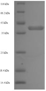 Human Napsin-A (NAPSA) Recombinant Protein, Homo sapiens (Human), E.coli, N-terminal 6xHis-tagged, 42.5 kDa, purity >≥ 90% as determined by SDS-PAGE.