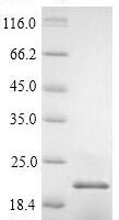 Daucus carota 21 kDa protein Recombinant Protein - BioCrest Sci