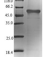 Cricetulus griseus Glutamine synthetase (GLUL) Recombinant Protein, N-His-SUMO - BioCrest Sci
