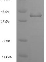 Staphylococcus aureus Enterotoxin type D (entD) Recombinant Protein - BioCrest Sci
