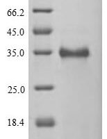 Human Cancer/testis antigen 2 (CTAG2) Recombinant Protein, N-His-SUMOstar - BioCrest Sci