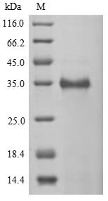 Human Cancer/testis antigen 2 (CTAG2) Recombinant Protein, N-His-SUMOstar, Homo sapiens (Human), Yeast, N-terminal 6xHis-sumostar-tagged, 34.2 kDa, purity >≥ 85% as determined by SDS-PAGE.