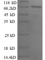 Human Paired box protein Pax-2 (PAX2), partial Recombinant Protein, N-GST - BioCrest Sci