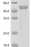 Human Somatotropin (GH1) Recombinant Protein, C-mFc - BioCrest Sci