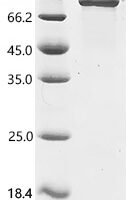 Human Mitotic spindle assembly checkpoint protein MAD1 (MAD1L1) Recombinant Protein - BioCrest Sci