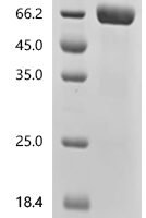 Mouse  Pro-neuregulin-1, membrane-bound isoform (Nrg1), partial Recombinant Protein - BioCrest Sci