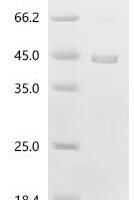 Human Ornithine transcarbamylase, mitochondrial (OTC) Recombinant Protein - BioCrest Sci