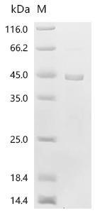 Human Ornithine transcarbamylase, mitochondrial (OTC) Recombinant Protein, Homo sapiens (Human), E.coli, C-terminal 6xHis-tagged, 43.1 kDa, purity >≥ 90% as determined by SDS-PAGE.