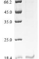 Bovine Myoglobin (MB) Recombinant Protein, Tag-Free - BioCrest Sci