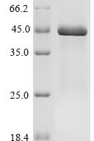 Human DNA replication licensing factor MCM9 (MCM9), partial Recombinant Protein - BioCrest Sci