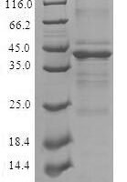 Human Complexin-2 (CPLX2) Recombinant Protein - BioCrest Sci