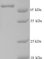 Human Casein kinase I isoform epsilon (CSNK1E) Recombinant Protein - BioCrest Sci