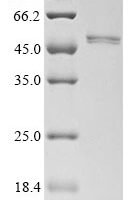 Mouse Sialidase-1 (Neu1) Recombinant Protein - BioCrest Sci