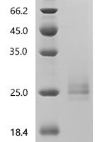 Human Methionine-R-sulfoxide reductase B2, mitochondrial (MSRB2), Biotinylated Recombinant Protein - BioCrest Sci