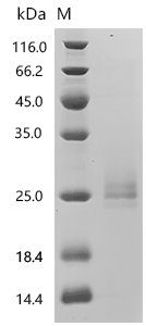 Human Methionine-R-sulfoxide reductase B2, mitochondrial (MSRB2), Biotinylated Recombinant Protein, Homo sapiens (Human), Mammalian cell, C-terminal 10xHis-Avi-tagged, 22.1 kDa, purity >≥ 90% as determined by SDS-PAGE.