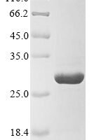 Rat Erythropoietin receptor (Epor), partial Recombinant Protein, C-His - BioCrest Sci