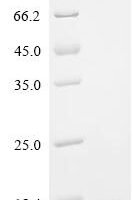 Human Ribonuclease 4  (RNASE4) Recombinant Protein - BioCrest Sci