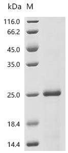 Human Inhibin beta E chain (INHBE) Recombinant Protein, N-His/C-Avi, Homo sapiens (Human), E.coli, N-terminal 6xHis-tagged and C-terminal Avi-tagged, 21.8 kDa, purity >≥ 90% as determined by SDS-PAGE.
