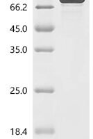Mouse Bone morphogenetic protein 7 (Bmp7) Recombinant Protein - BioCrest Sci