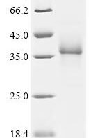 Human Cytochrome c oxidase subunit 1 (MT-CO1), partial Recombinant Protein, C-hFc1 - BioCrest Sci