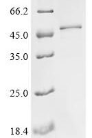 Human Complement C1q subcomponent subunit C (C1QC), partial Recombinant Protein - BioCrest Sci