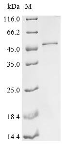 Human Complement C1q subcomponent subunit C (C1QC), partial Recombinant Protein, Homo sapiens (Human), E.coli, N-terminal 10xHis-GST-tagged and C-terminal Myc-tagged, 48.3 kDa, purity >≥ 85% as determined by SDS-PAGE.