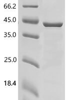 Human Acetylserotonin O-methyltransferase(ASMT) Recombinant Protein - BioCrest Sci