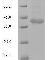 Human Tripartite motif-containing protein 72 (TRIM72), partial Recombinant Protein - BioCrest Sci