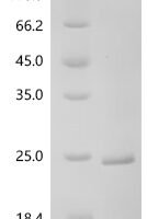 Human Histone H2A type 2-A (H2AC18) Recombinant Protein - BioCrest Sci