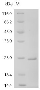 Human Histone H2A type 2-A (H2AC18) Recombinant Protein, Homo sapiens (Human), E.coli, C-terminal 6xHis-tagged, 20.9 kDa, purity >≥ 95% as determined by SDS-PAGE.