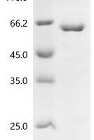 Human RNA-binding protein Nova-1 (NOVA1) Recombinant Protein, C-His, aa 1–507, E.coli - BioCrest Sci