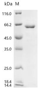 Human RNA-binding protein Nova-1 (NOVA1) Recombinant Protein, C-His, aa 1–507, E.coli, Homo sapiens (Human), E.coli, C-terminal 6xHis-tagged, 58.6 kDa, purity >≥ 85% as determined by SDS-PAGE.