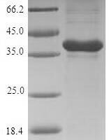Rat Gremlin-1 (Grem1) Recombinant Protein, N-His-SUMO - BioCrest Sci
