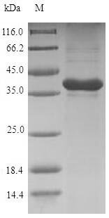 Rat Gremlin-1 (Grem1) Recombinant Protein, N-His-SUMO, Rattus norvegicus (Rat), E.coli, N-terminal 6xHis-SUMO-tagged, 34.2 kDa, purity >≥ 90% as determined by SDS-PAGE.