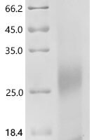 Mouse Probetacellulin (Btc), partial Recombinant Protein, C-10His - BioCrest Sci