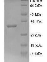 Mycobacterium tuberculosis Signal peptidase I (lepB), partial Recombinant Protein, N-His - BioCrest Sci