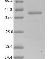 Human Actin-related protein 2/3 complex subunit 5-like protein (ARPC5L) Recombinant Protein - BioCrest Sci