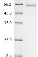 Horse Matrix metalloproteinase-9 (MMP9), partial Recombinant Protein - BioCrest Sci