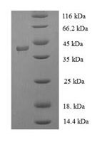 Human Filaggrin (FLG), partial Recombinant Protein, N-His-SUMO - BioCrest Sci