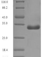 Escherichia coli F17 fimbrial protein (F17a-A) Recombinant Protein - BioCrest Sci