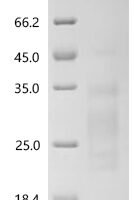 Human Mannose-binding protein C (MBL2) Recombinant Protein, N-His-SUMOstar - BioCrest Sci