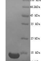 Human Transcription intermediary factor 1-alpha (TRIM24), partial Recombinant Protein - BioCrest Sci