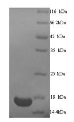 Human Transcription intermediary factor 1-alpha (TRIM24), partial Recombinant Protein, Homo sapiens (Human), Yeast, N-terminal 6xHis-tagged, 16.5 kDa, purity >≥ 90% as determined by SDS-PAGE.