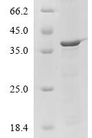 Human Filaggrin (FLG), partial Recombinant Protein, N-His-B2M - BioCrest Sci