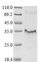 Human Interleukin-7 receptor subunit alpha (IL7R), partial Recombinant Protein, N-10His/C-Myc - BioCrest Sci