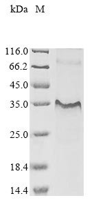 Human Interleukin-7 receptor subunit alpha (IL7R), partial Recombinant Protein, N-10His/C-Myc, Homo sapiens (Human), E.coli, N-terminal 10xHis-tagged and C-terminal Myc-tagged, 30.3 kDa, purity >≥ 85% as determined by SDS-PAGE.