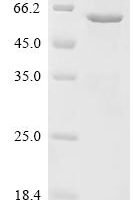 Human Angiopoietin-related protein 6 (ANGPTL6) Recombinant Protein - BioCrest Sci