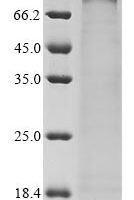 Human Semaphorin-3G (SEMA3G) Recombinant Protein - BioCrest Sci