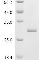 Foot-and-mouth disease virus Genome polyprotein, partial Recombinant Protein - BioCrest Sci