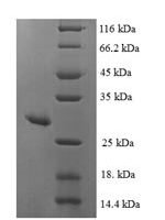 Human Mitochondrial peptide methionine sulfoxide reductase (MSRA) Recombinant Protein - BioCrest Sci
